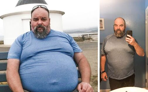 Photo before and after the course of Keto Probiotix, the experience of using capsules with migiel from Venice